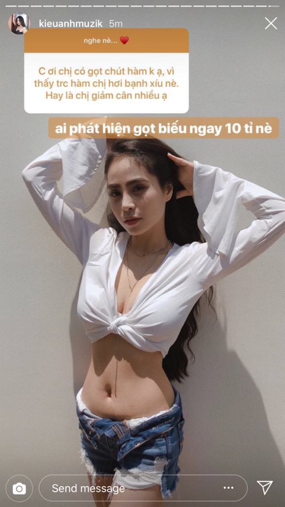 Ca nương Kiều Anh đanh thép phản pháo tin đồn gọt hàm: Ai phát hiện biếu ngay 10 tỷ