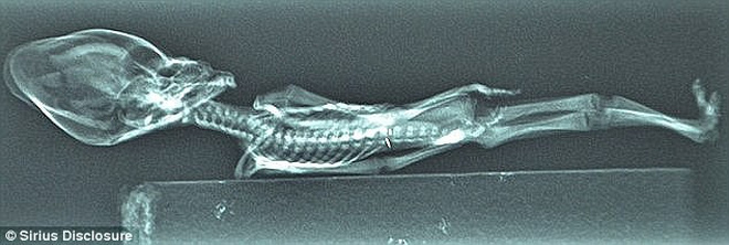 Tranh cãi về bộ hài cốt tí hon nghi là người ngoài hành tinh được phát hiện ở Chile Tranh cãi về bộ hài cốt tí hon nghi là người ngoài hành tinh được phát hiện ở Chile