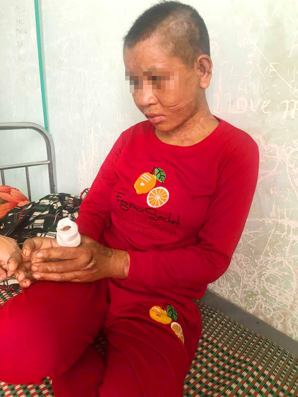 Vụ người phụ nữ bị tra tấn ở Gia Lai: Đối tượng nói bị bỏ thuốc thư?