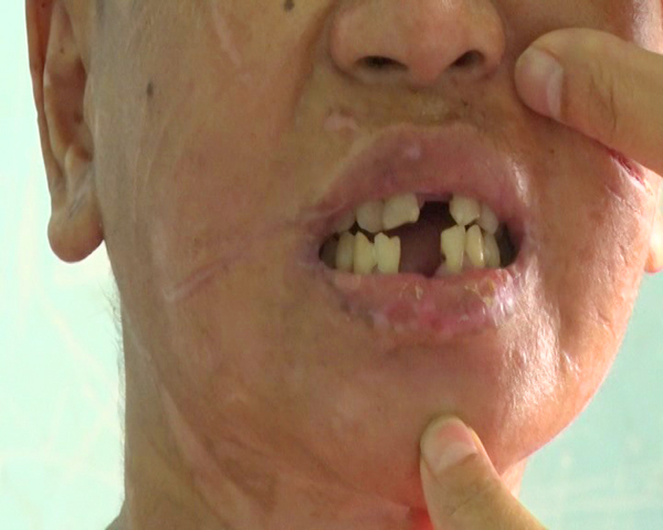 Vụ người phụ nữ bị tra tấn ở Gia Lai: Đối tượng nói bị bỏ thuốc thư?