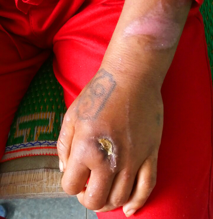 Vụ người phụ nữ bị tra tấn ở Gia Lai: Đối tượng nói bị bỏ thuốc thư?