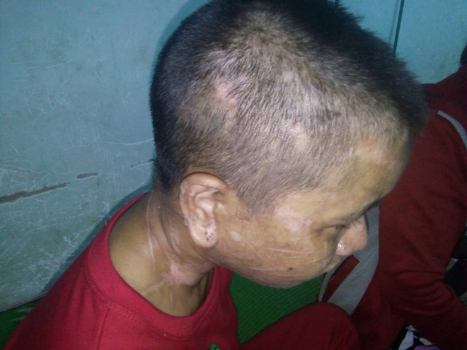 Vụ cô gái nghi bị tra tấn dã man: Sau nửa tháng đánh đập, nạn nhân phát hiện bị sẩy thai