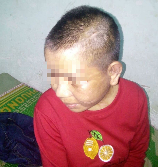 Vụ cô gái nghi bị tra tấn dã man: Sau nửa tháng đánh đập, nạn nhân phát hiện bị sẩy thai