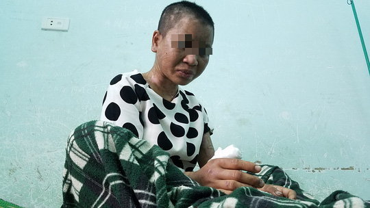 Lời kể rùng rợn của cô gái nghi bị chủ tra tấn dã man