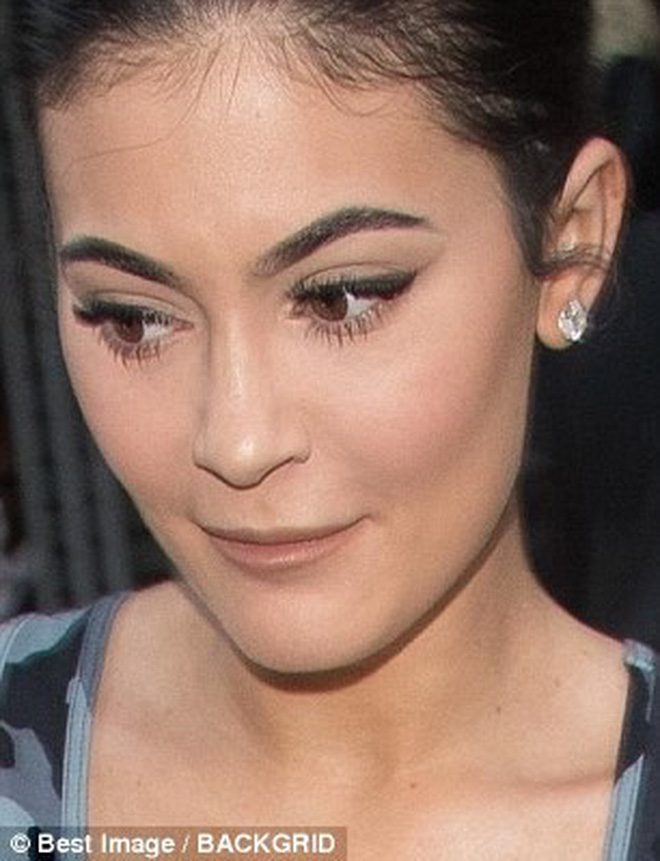 Nữ hoàng môi tều Kylie Jenner gây xôn xao vì đôi môi mỏng dính khó nhận ra sau khi rút filler