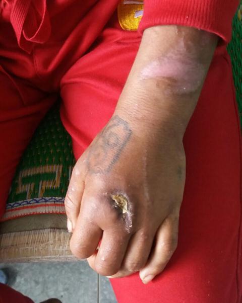 Vụ tra tấn người làm dã man: Đăng clip đánh lên Facebook