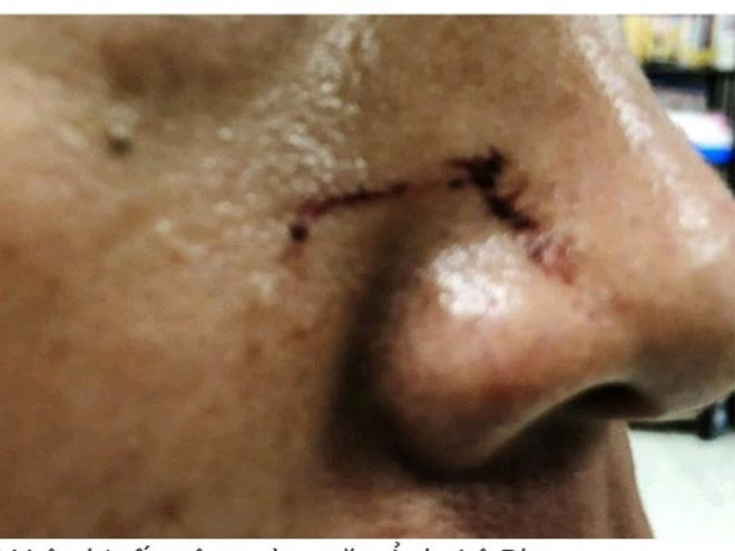 Kiểm sát viên bị đánh tại tòa Bình Chánh nói gì?