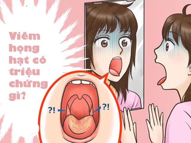Triệu chứng viêm họng hạt là gì? Triệu chứng viêm họng hạt là gì?