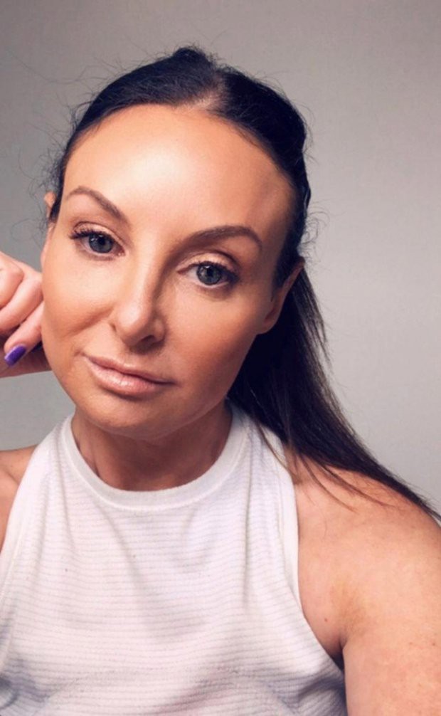 Để đỉa hút máu cứu chiếc mũi phẫu thuật thẩm mỹ hỏng