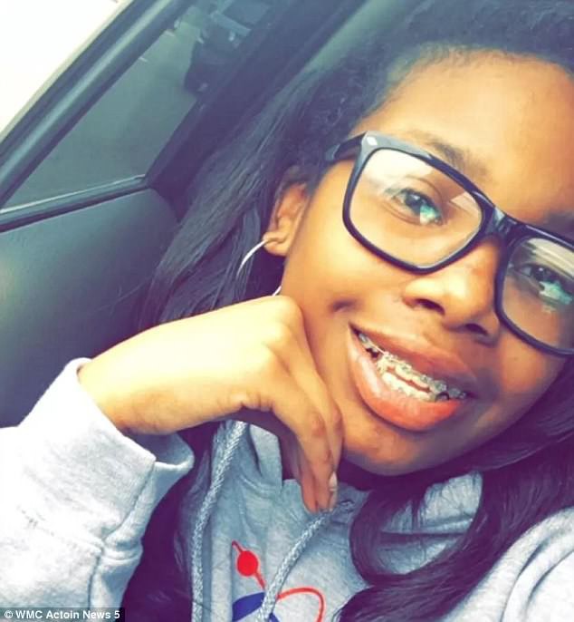 Rùng mình trước những tai nạn niềng răng đáng sợ trên thế giới