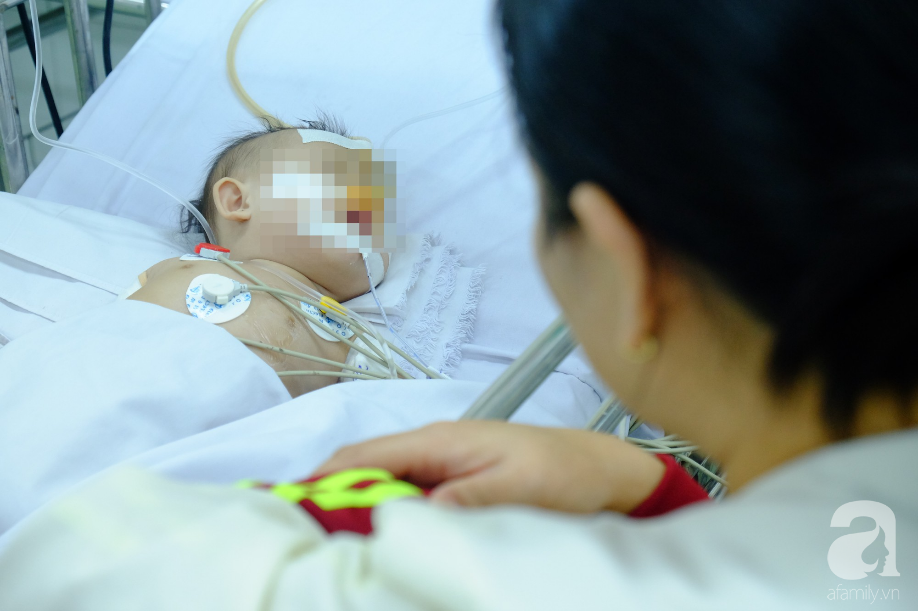 Uống nhầm nước tro tàu làm bánh ú, bé gái 3 tuổi bị bỏng thực quản