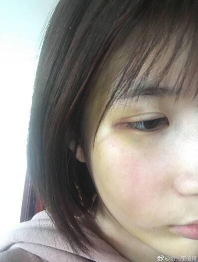 Vừa mới hot với Diên Hi Công Lược, mỹ nam 1995 bị bóc phốt ngoại tình, đánh bạn gái dã man