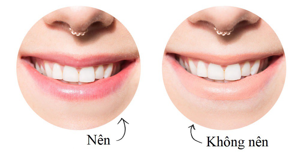 Để tránh chọn son làm xỉn răng như Sulli, hãy nắm rõ loạt bí kíp nên và không nên này