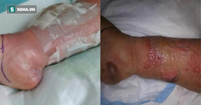 Đi làm móng chân, một phụ nữ nhận được kết quả kinh hoàng: Sự việc có 150.000 lượt chia sẻ