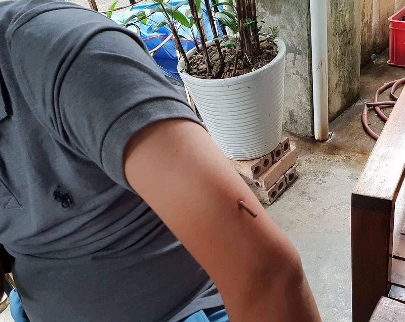 Đang ngồi quán cà phê thì bị bắn