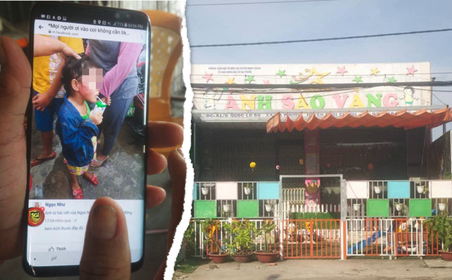 Gia đình bé 5 tuổi bị tát sưng mặt không muốn truy tố cô giáo vì thấy... tội nghiệp