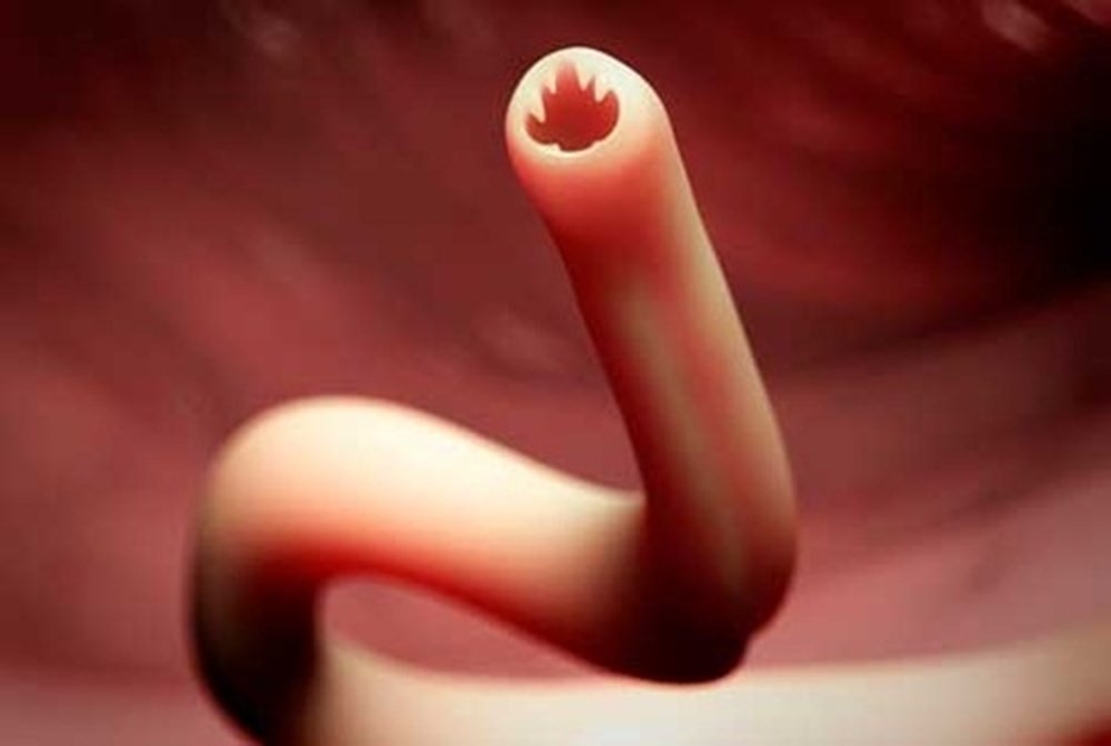 Từ 1 thói quen khi đi biển ai cũng từng làm: Chuyên gia cảnh báo về khả năng bị nhiễm loại kí sinh trùng nguy hiểm