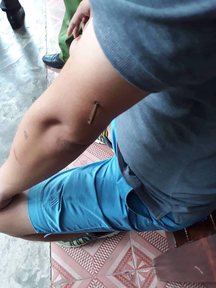 Quảng Bình: Điều tra vụ chủ quán cà phê bị bắn giữa ban ngày