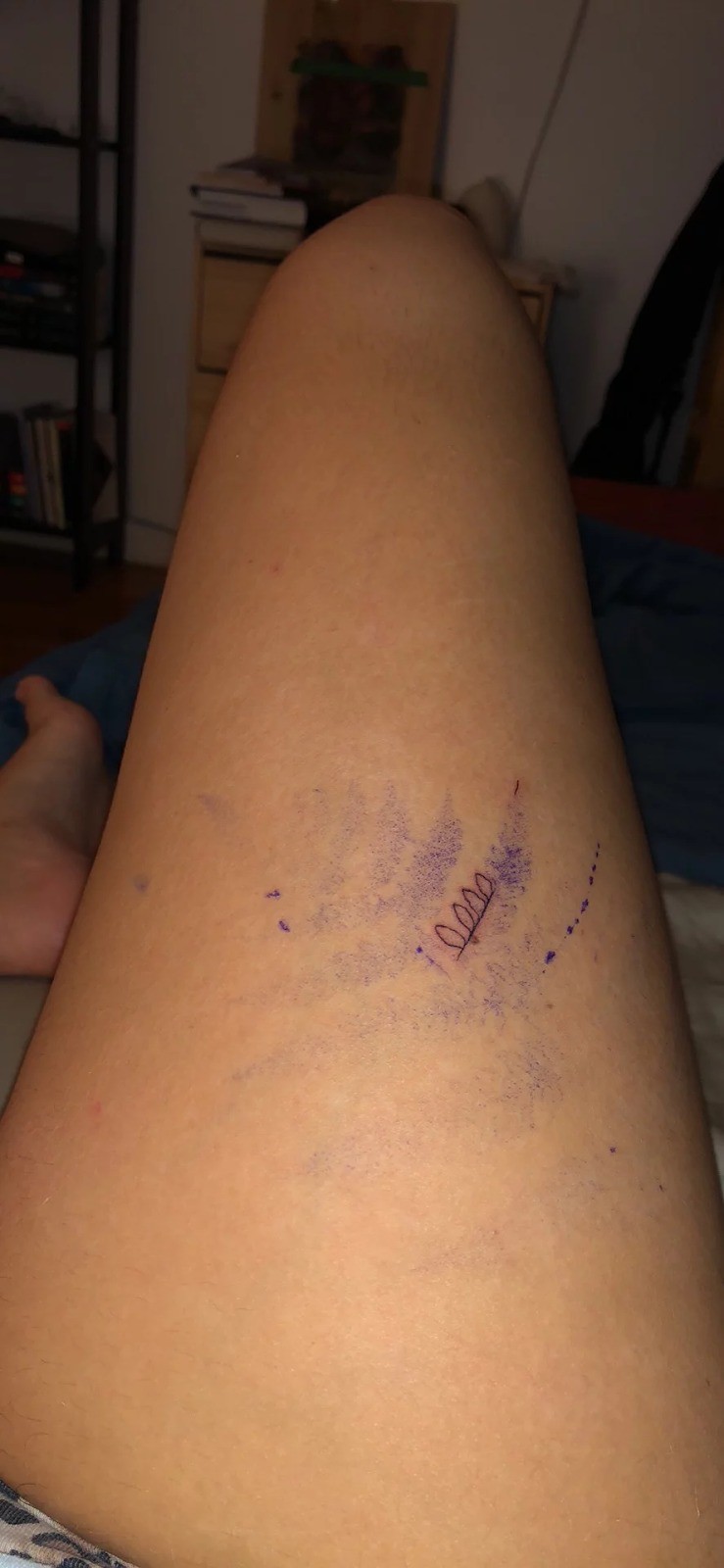 Cô gái sợ kim lần đầu đi xăm: Ngất xỉu sau 3 phút lên thớt, hình xăm dang dở khiến dân mạng cười không nhặt được mồm