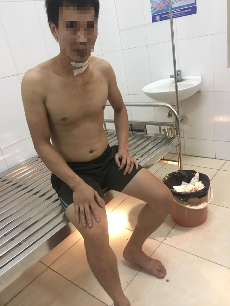 Lời kể của tài xế taxi ở Hà Nội bị nam hành khách cứa cổ trong đêm