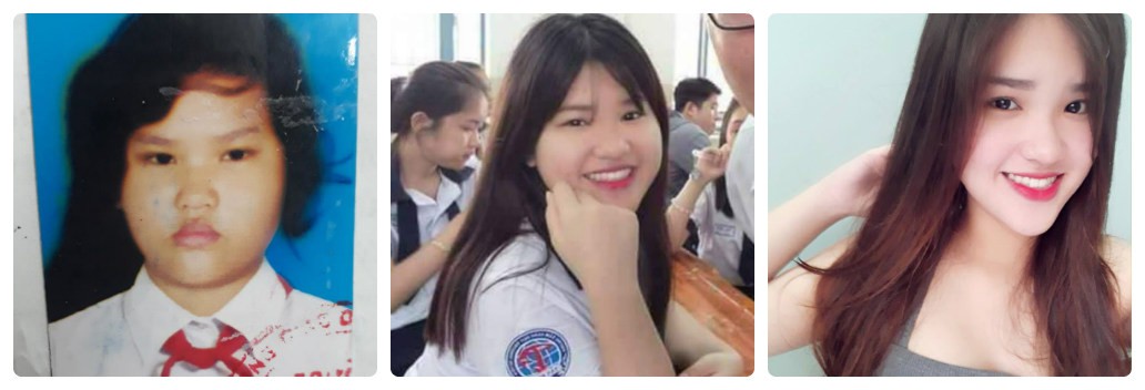 Từng bị bạn bè trêu chọc gọi là Happy Polla phiên bản Việt, cô gái lột xác ngỡ ngàng thành hot girl