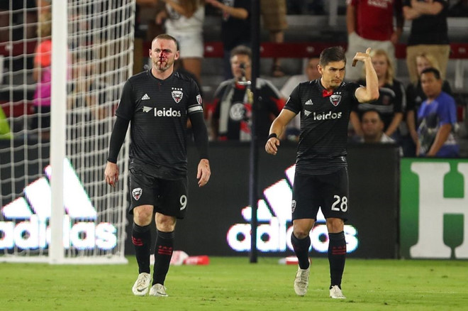 Rooney mặt đầm đìa máu trong ngày ghi bàn đầu tiên cho DC United