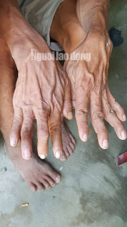 Cuộc sống khó khăn của người khổng lồ cao hơn 2,1 m ở miền Tây