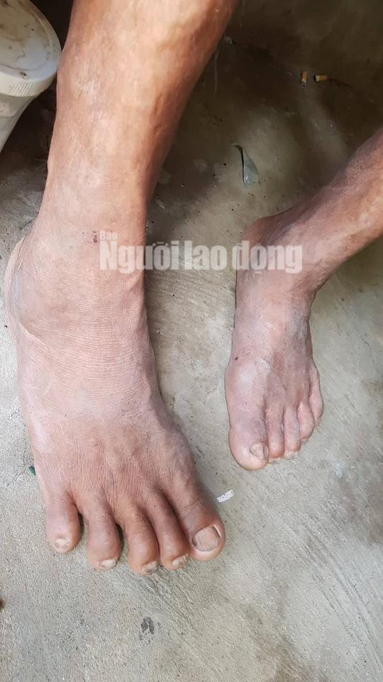 Cuộc sống khó khăn của người khổng lồ cao hơn 2,1 m ở miền Tây