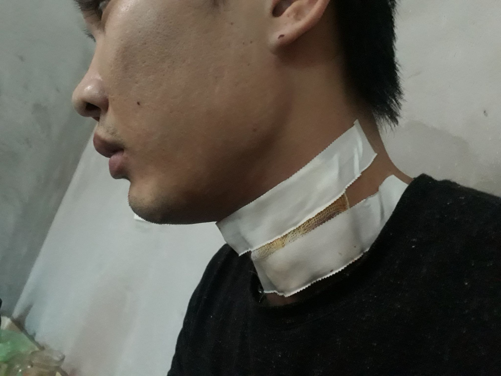 Bắt 2 nghi phạm cầm dao cứa cổ tài xế taxi trong đêm