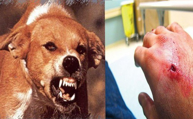 Người đàn ông chết sau 1 tháng bị chó nhà cắn vì không tiêm phòng dại