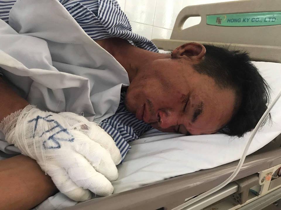 Hé lộ nguyên nhân rể cũ mang xăng đốt nhà và đâm bố vợ bị thương ở Hà Nội