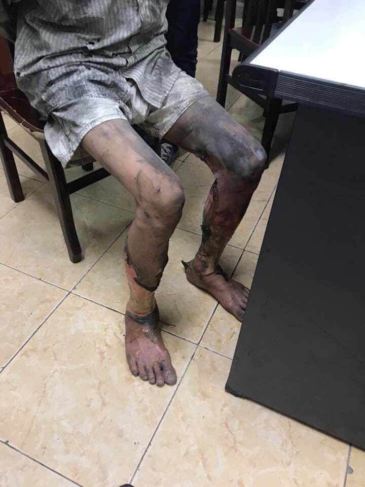 Hé lộ nguyên nhân rể cũ mang xăng đốt nhà và đâm bố vợ bị thương ở Hà Nội