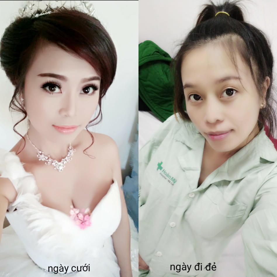 Đua nhau so sánh ảnh lúc cưới và lúc đi đẻ, hội chị em nhìn xong không dám tin đó chính là mình