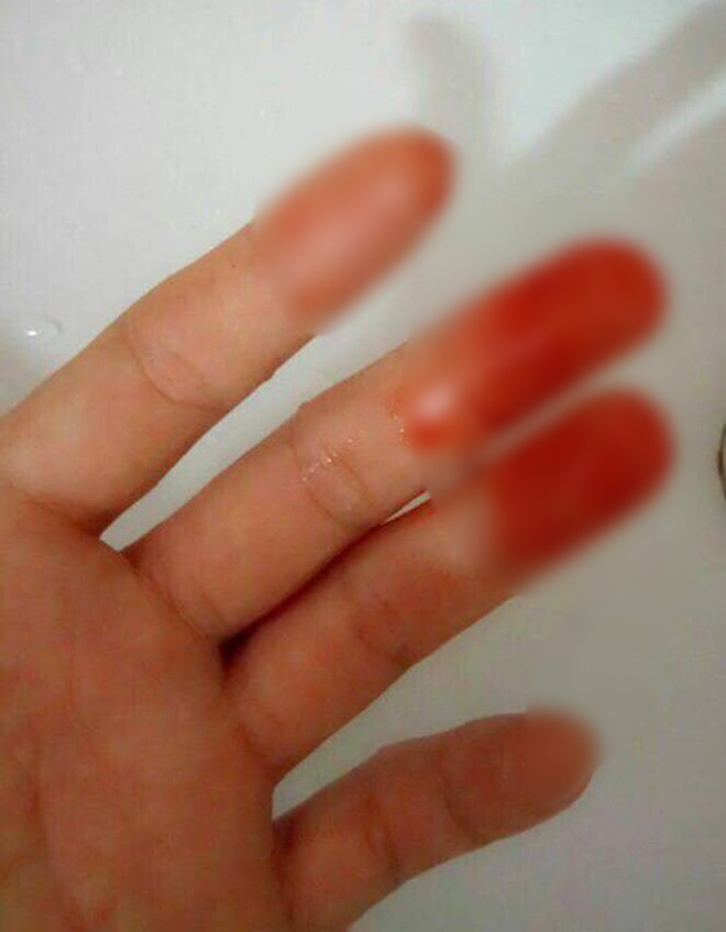 Nữ sinh bị nam chủ nhà tát, đuổi ra khỏi nhà trọ lên tiếng: Nhiều lần tôi còn cho hai vợ chồng ấy vay tiền, mượn xe...