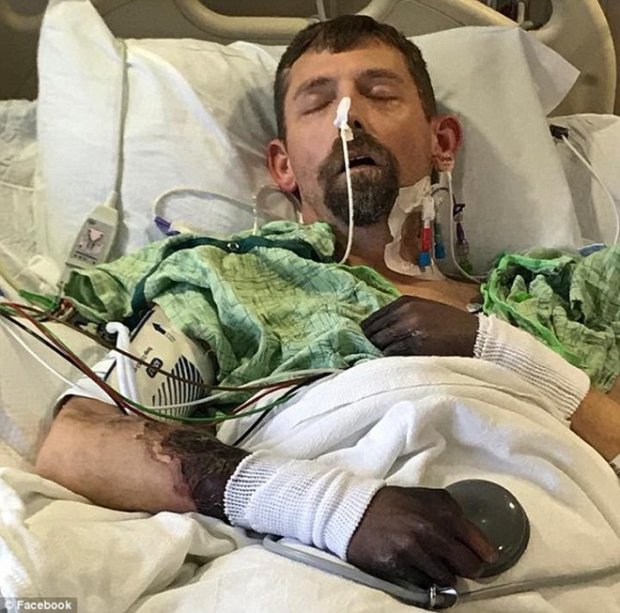 Đâm đơn kiện bệnh viện sau khi phải cắt cụt tứ chi vì nhiễm vi khuẩn ăn thịt người