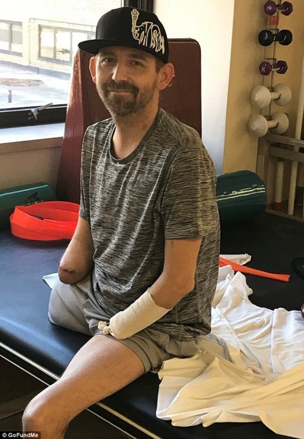 Đâm đơn kiện bệnh viện sau khi phải cắt cụt tứ chi vì nhiễm vi khuẩn ăn thịt người