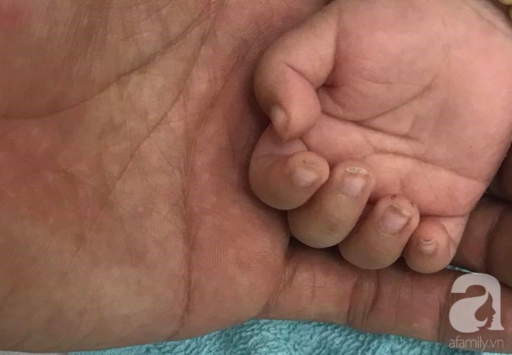 TP.HCM: Cha không giữ được bình tĩnh, lỡ taylàm con trai 2 tháng tuổi xuất huyết não vì quấy khóc không chịu ngủ