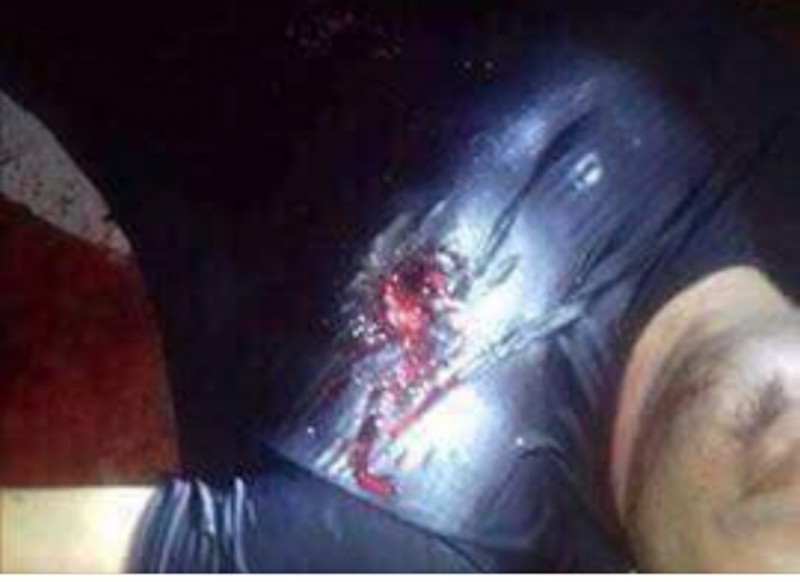 Hải Phòng: Mâu thuẫn tiền bạc, sếp xả súng bắn chết lái xe