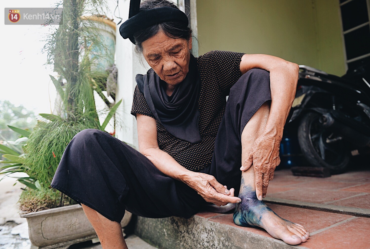 Người dân Chương Mỹ trong trận lụt lịch sử: Trẻ nhỏ chưa được đến trường, người già lở loét da sau nửa tháng ngâm mình trong nước