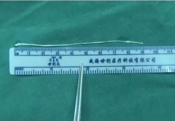 Con gái 6 tuổi bỗng bị co giật, cha mẹ tưởng chuột rút nhưng 12 năm sau mới tá hỏa