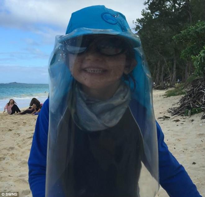 Xót xa những đứa trẻ mắc căn bệnh lạ cứ tiếp xúc với ánh sáng là chết