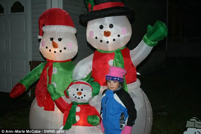 Xót xa những đứa trẻ mắc căn bệnh lạ cứ tiếp xúc với ánh sáng là chết