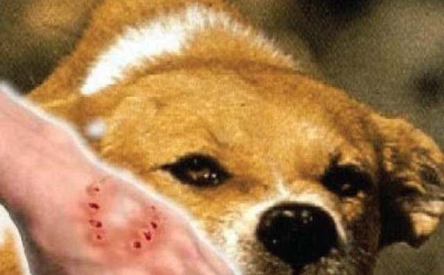 Sợ vắc xin phòng dại gây hại không chịu tiêm phòng có thể mất cả tính mạng Sợ vắc xin phòng dại gây hại không chịu tiêm phòng có thể mất cả tính mạng