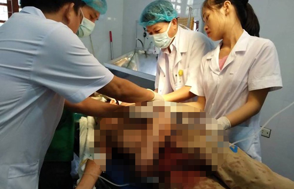 Nghịch súng bắn chết bạn, nam sinh hốt hoảng cứa cổ tự sát