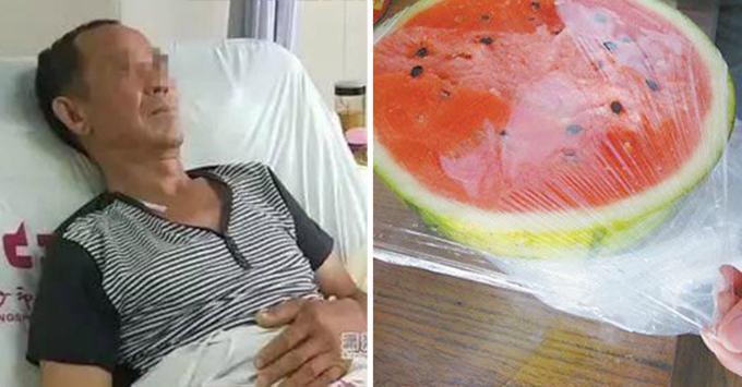 Người đàn ông bị cắt 70 cm ruột sau khi ăn dưa hấu bảo quản trong tủ lạnh