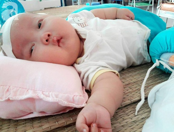Mẹ trẻ đau đớn cầu xin mạnh thường quân cứu con trai bị não úng thủy từ lúc 2 tháng tuổi