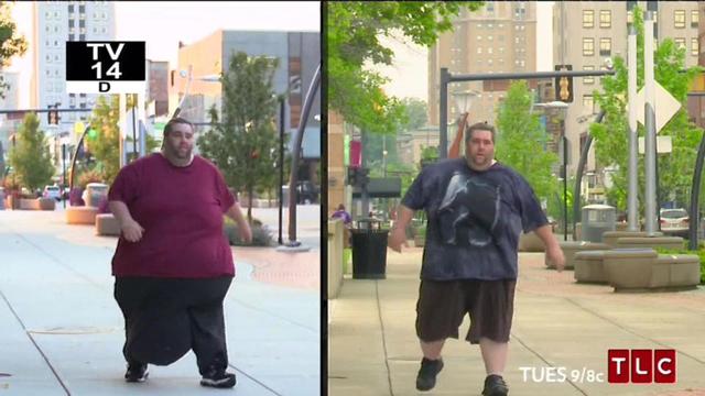 Bi kịch của người đàn ông có của quý khổng lồ, nặng gần 32kg