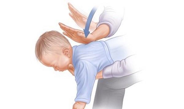 Chuyện đau lòng có thật: Mẹ bất lực nhìn con bị tử thần đưa đi vì... trà sữa trân châu