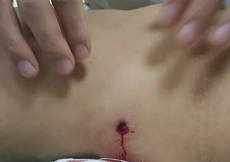 Nam Định: Côn đồ bắn nhau ở chân cầu Đò Quan, một người dân trúng đạn tử vong