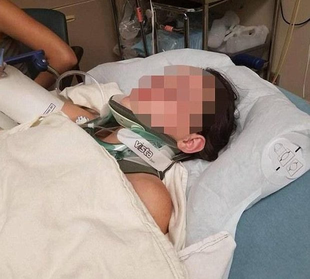 Nữ sinh gãy xương sườn, thủng phổi vì bị bạn xô ngã từ độ cao 20 m